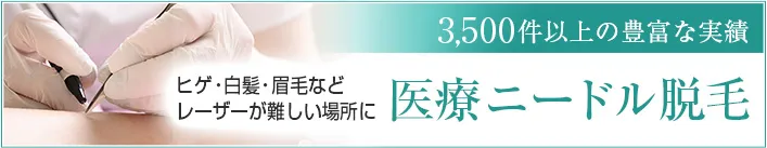 3,500件以上の豊富な実績 医療ニードル脱毛