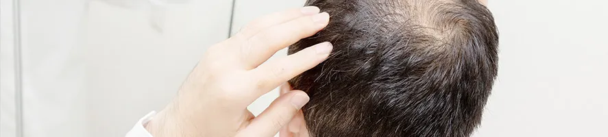 頭皮・毛髪のお悩み