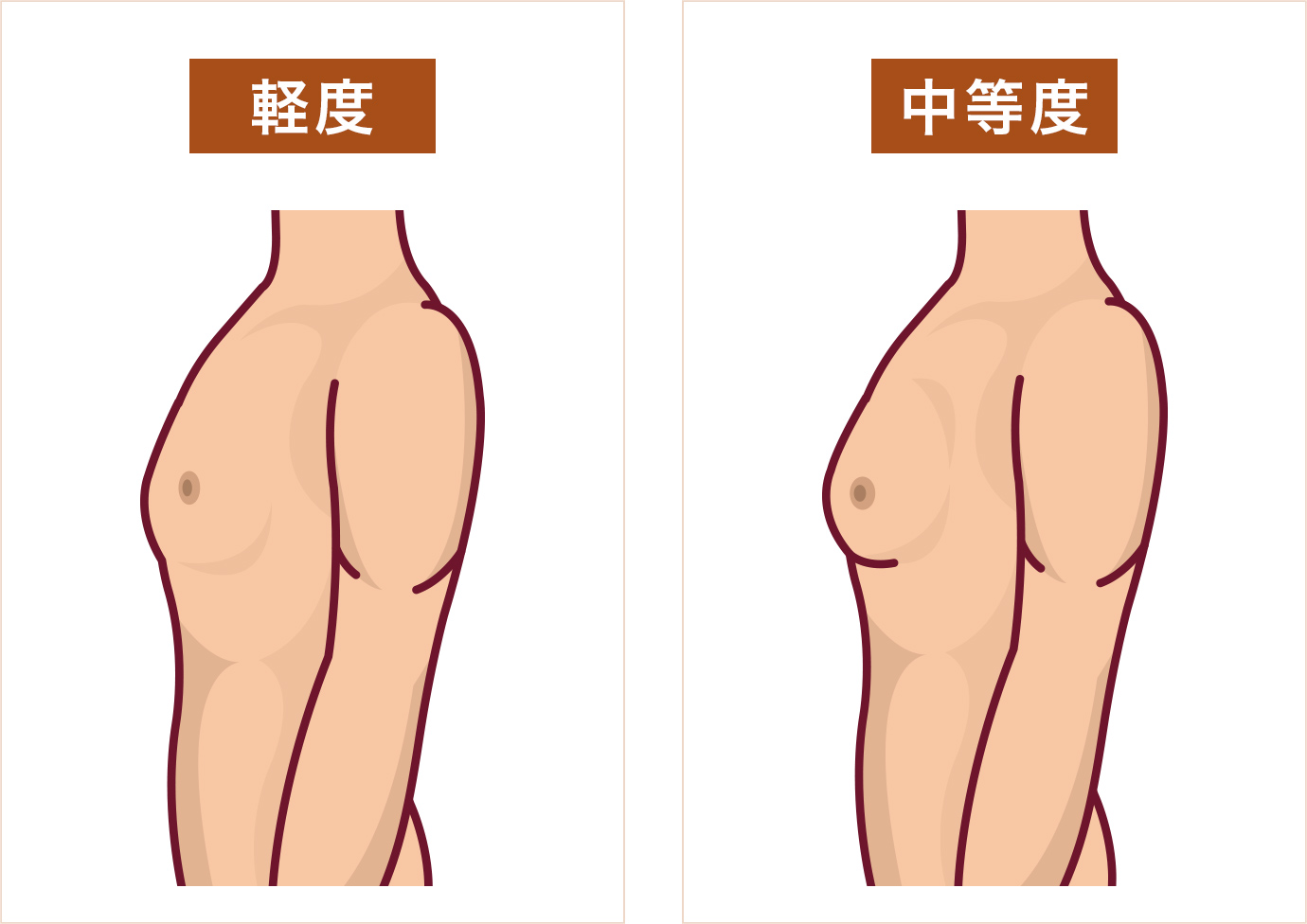 女性化乳房でお悩みなら 鎌倉市大船の形成外科 美容外科 大船t S形成クリニック